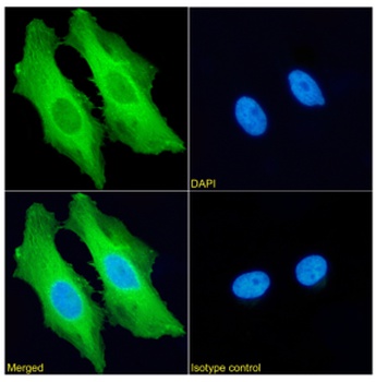 HSPB1 Antibody [SAIC-23C-35], Rabbit IgG