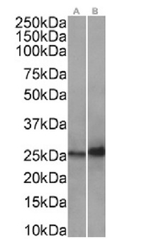 HSPB1 Antibody [SAIC-23B-22], Rabbit IgG