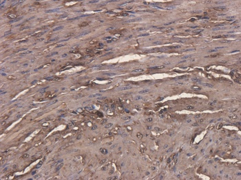 carcinoembryonic antigen (CEA) Antibody [Arcitumomab], Human IgG1 - Research Grade Biosimilar