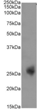 CD3 epsilon Antibody [YTH 12.5], Rabbit IgG