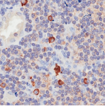 CD3 epsilon Antibody [YTH 12.5], Rabbit IgG