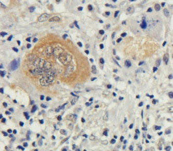 Bax (active monomer) Antibody [6A7], Rabbit IgG