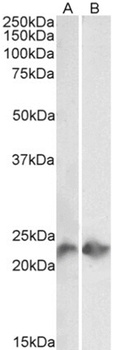 CD3 epsilon Antibody [UCHT1], Mouse IgG1