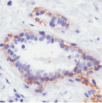 erbB-2 (Her-2/neu) Antibody [4D5-8 (trastuzumab)], Rabbit IgG - Research Grade Biosimilar