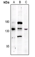 Anti-PERK (Phospho-T982) Antibody