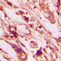 Anti-PERK (Phospho-T982) Antibody