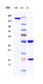 Anti-ALCAM/CD166 Reference Antibody (praluzatamab ravtansine)