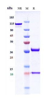 Anti-PCSK9 Reference Antibody (lodelcizumab)