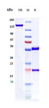 Anti-TNFRSF18 / GITR / CD357 Reference Antibody (Korea Natl.Cancer Ctr. patent anti-GITR)