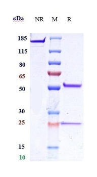 Anti-IL-25 Reference Antibody (Centocor patent anti-IL-25)