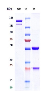 Anti-TNFSF7 / CD27L / CD70 Reference Antibody (cusatuzumab)