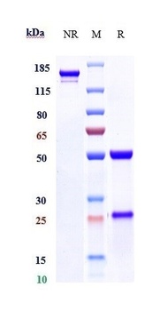 Anti-GOLM1 Reference Antibody (Cureab patent anti-GP73)