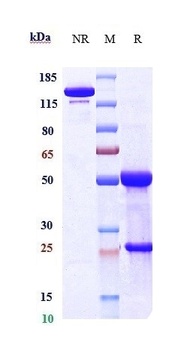 Anti-GREM1 / Gremlin Reference Antibody (UCB patent anti-Gremlin-1)