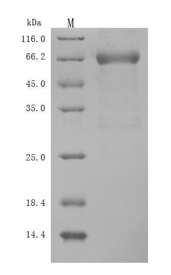 Recombinant Human Leukemia inhibitory factor (LIF) (Active)