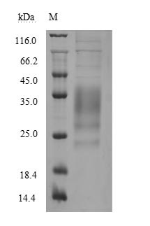 Recombinant Human Tumor necrosis factor ligand superfamily member 8 (TNFSF8), partial (Active)