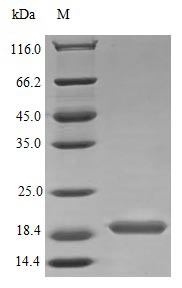 Human IL17B protein (Active)