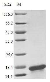 Human IL17F protein (Active)