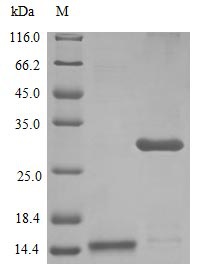 Human IL17 protein (Active)