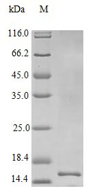 Human IL22 protein (Active)