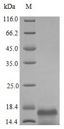 Human CSF1 protein (Active)