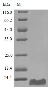 Human CCL20 protein (Active)