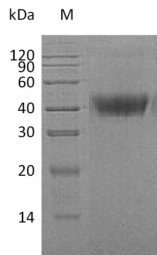 Human CSF1 protein