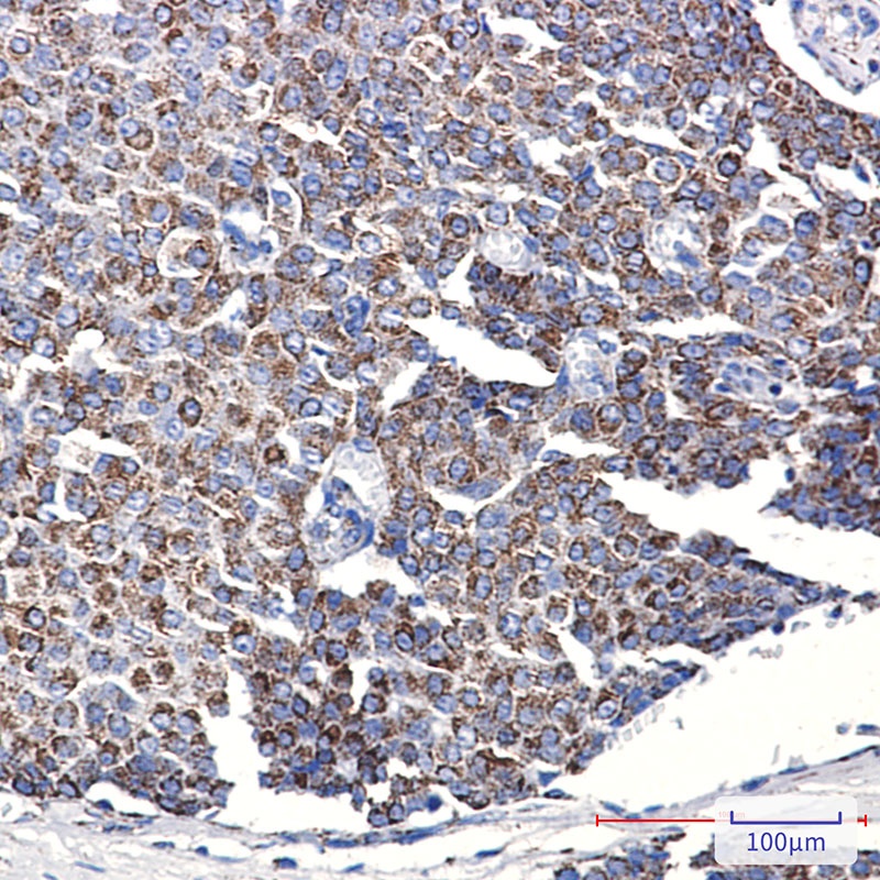 TOMM20 Rabbit mAb