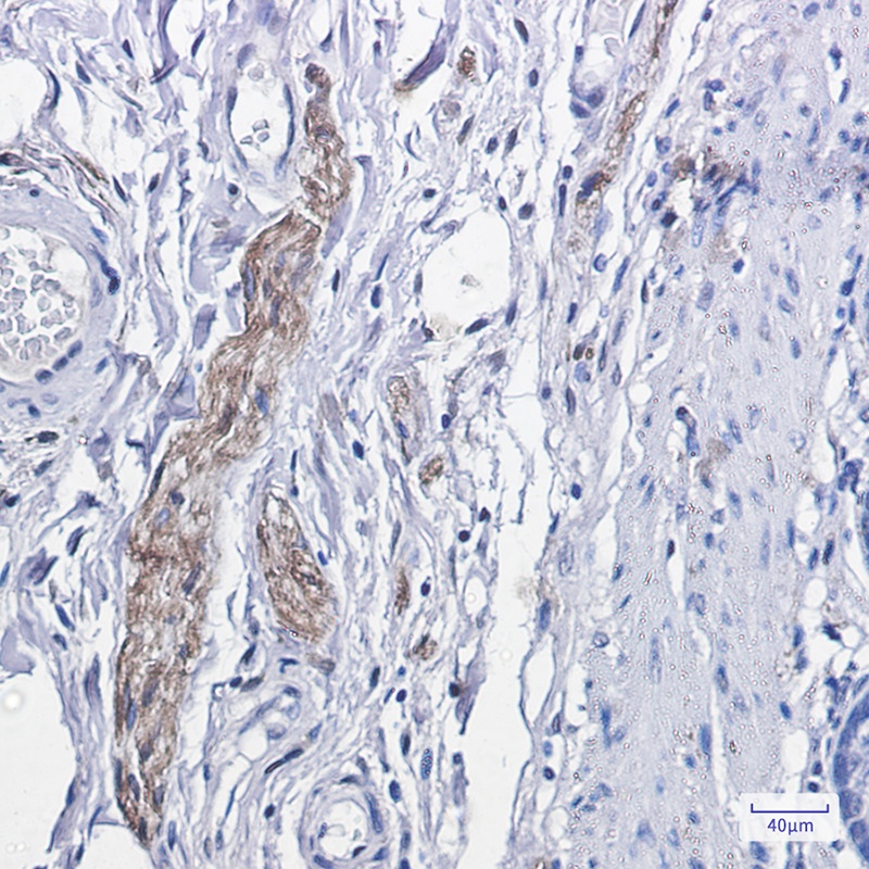 [KO] Phospho-PKC alpha (Thr638) Rabbit mAb