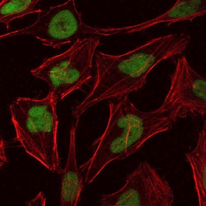 MCM2 (2B5) Mouse mAb