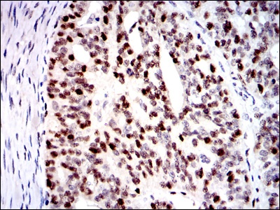 MCM2 (2B5) Mouse mAb
