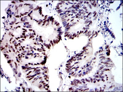 MCM2 (2B5) Mouse mAb