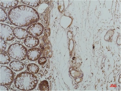 GRP78 BiP (9C7) Mouse mAb