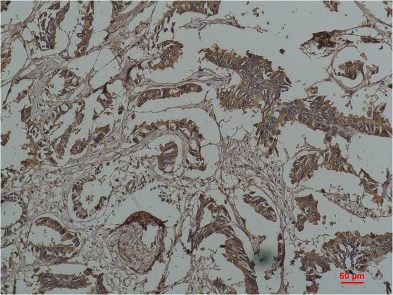Hsp27 (9G1) Mouse mAb