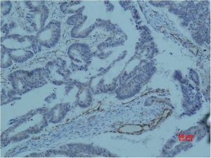 Survivin (8B9) Mouse mAb