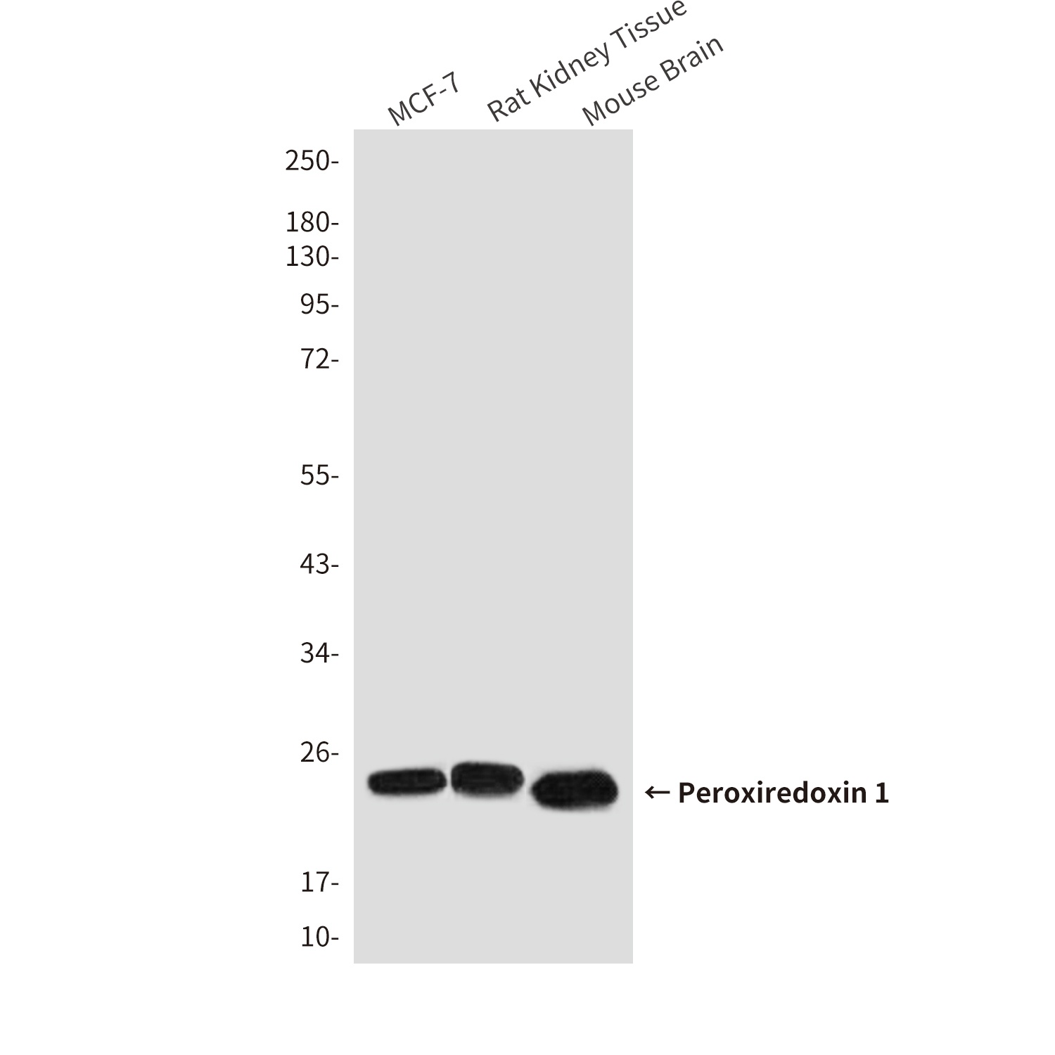 Peroxiredoxin 1 (6A6) Mouse mAb