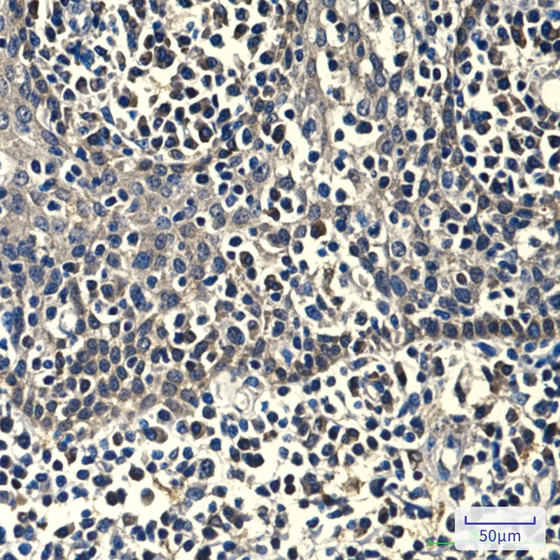Peroxiredoxin 1 (6A6) Mouse mAb
