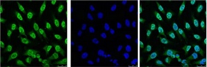 p53 (2D10) Mouse mAb