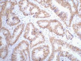 p53 (2D10) Mouse mAb