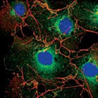 LPP (6F6) Mouse mAb