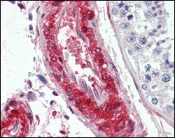LPP (6F6) Mouse mAb