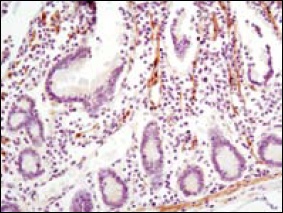LPP (6F6) Mouse mAb