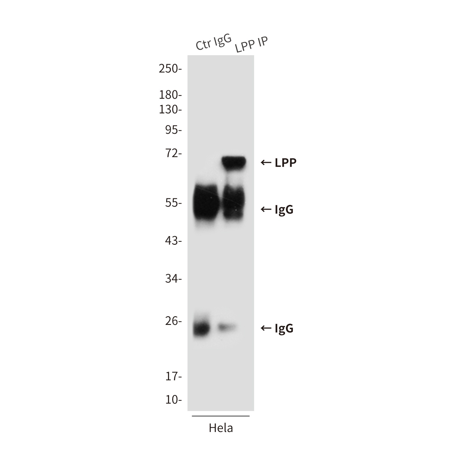 LPP (6F6) Mouse mAb