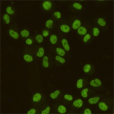 SAFB1 (2E8) Mouse mAb