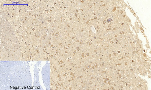 VEGF Receptor 2 Rabbit pAb