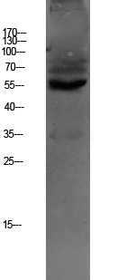 OAT1 Rabbit pAb
