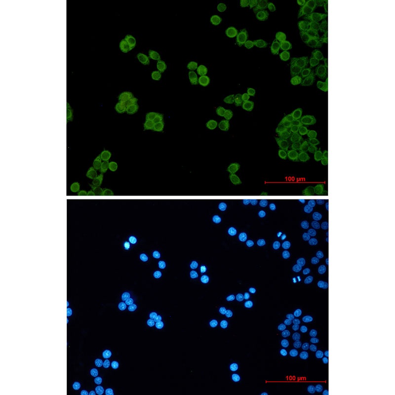 PEN2 Rabbit mAb