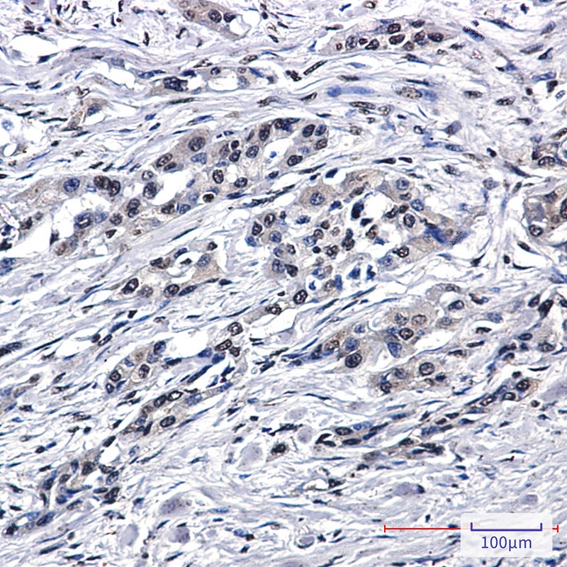 PEN2 Rabbit mAb