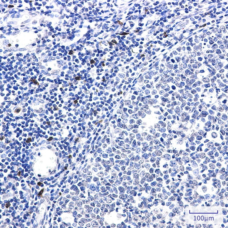 IL-26 Rabbit mAb