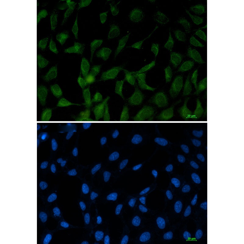 FE65 Rabbit mAb