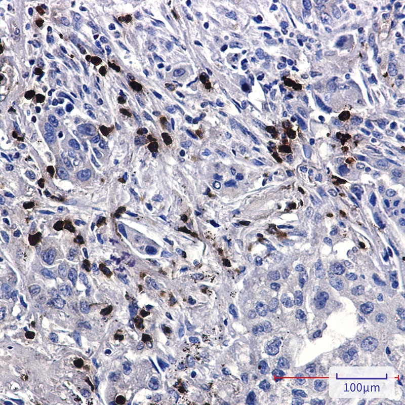 FE65 Rabbit mAb